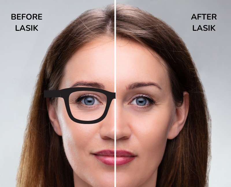 LASIK Laser: The Game-Changer in Vision Correction